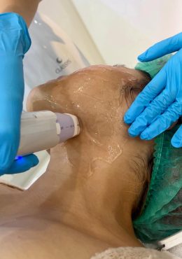 กระชับกรอบหน้า-compressed