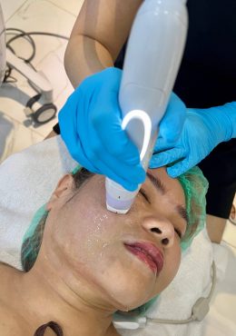 กระตุ้นคอลลาเจน-compressed